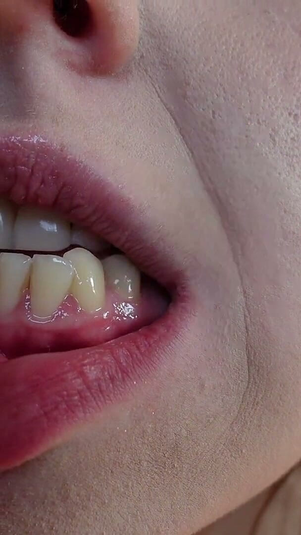 HotRedWildcat: Je Me Nettoie Les Dents Avec Du Fil Dentaire