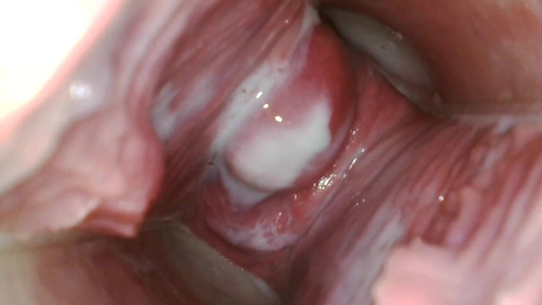 JANA studios: Endoscope in my pussy