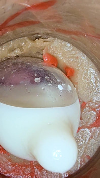The Camera 4K Inside the Deep Pussy Records a Huge Ejaculation with a Stuck Condom