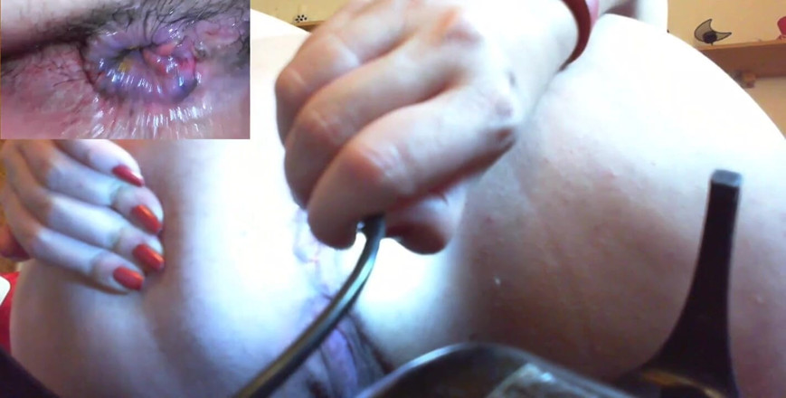 Nicoletta Embassi: Lékařský anální endoskop fisting a extrémní masturbace