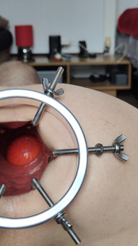 Vibrating Ball Ft David Anderson