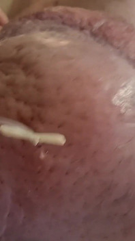 Extreme Fillings Inside My Siliconemeat