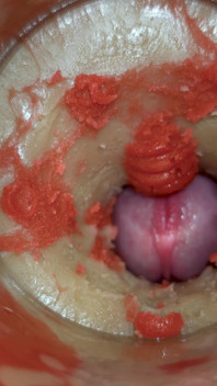 Camera 4K in Vagina, Cervix POV