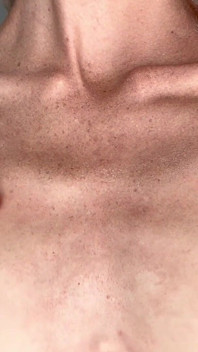 Blond žebra fetiš klíční kost hubený žaludek vakuové kosti show