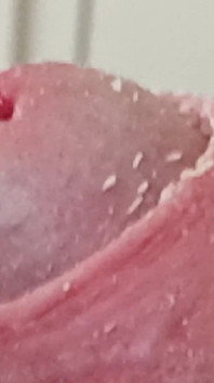 Smegma Foreskin Roll. Bigpisser