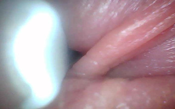 Twittiy: Endoscoopcamera toont de meest gevoelige delen van de penis educatieve...