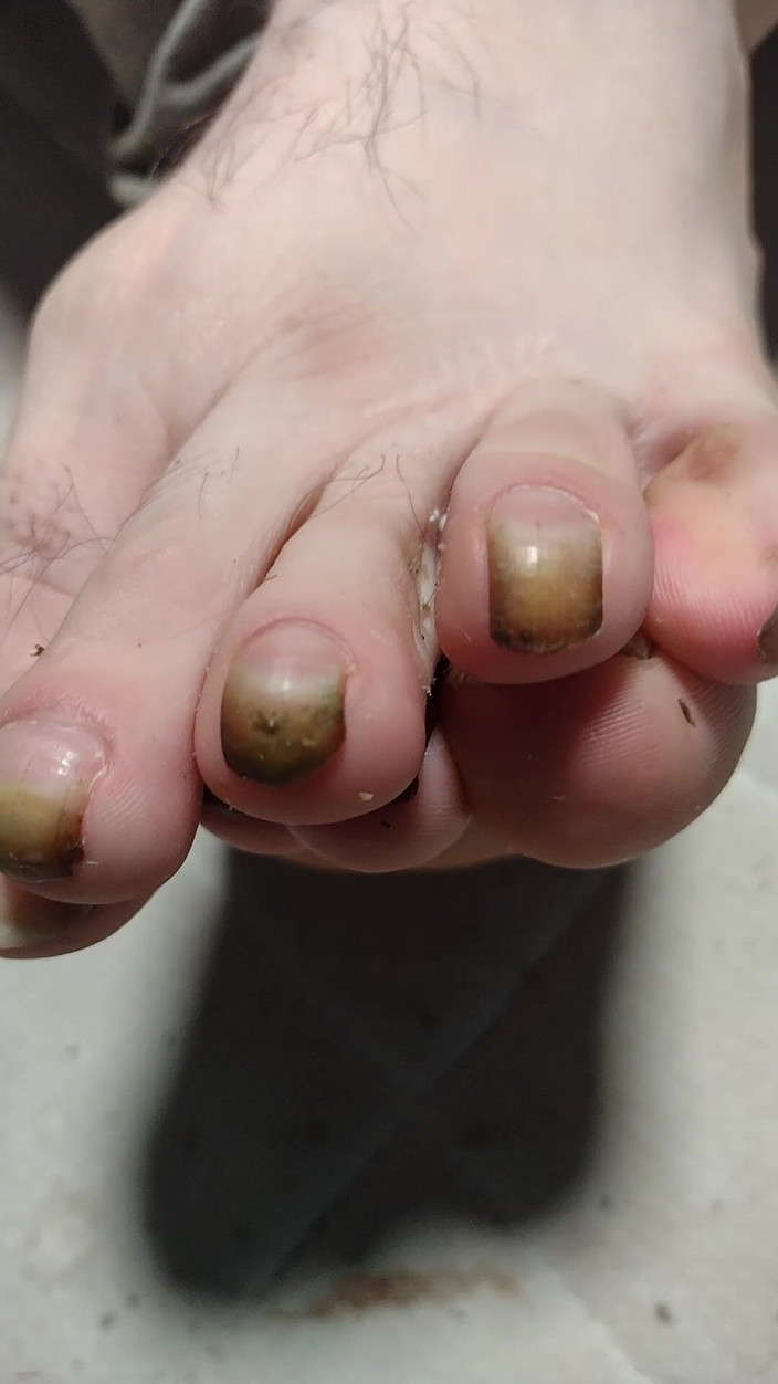 Au79: 为你释放我裸脚的美丽