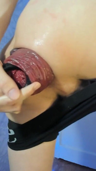 I Demonstrate a Huge Prolapse and Insert a Toy Right Into It