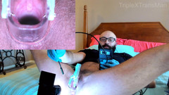TripleXTransMan: Gyno Torment ve společnosti Tele anáh Doctor Visit, Medfet Gynecology...