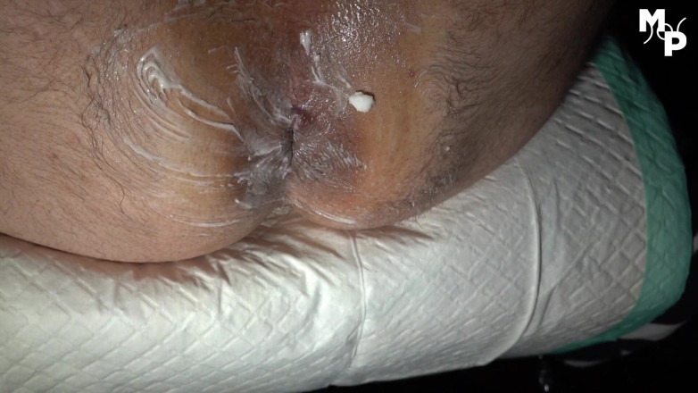Marcus Pollack Gay: Áspero fisting anal con guantes de limpieza