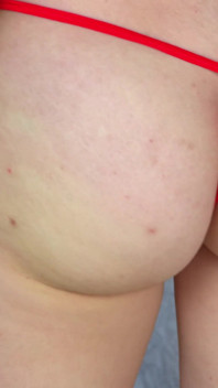 Arielle Lane - Cubaan Thong Merah Laser