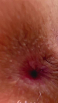 Challenge: Never Wash Pussy of Young Girl Then Shave It and Pour Shampoo on Feet