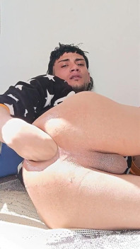 My Prolapse
