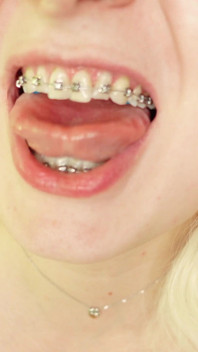 Eating in Braces, Food Fetish Video Devour