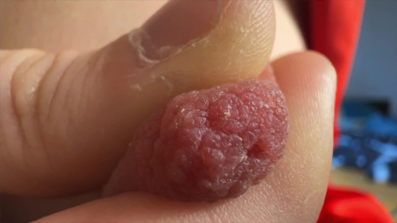 Skinny_lady69: 超级特写