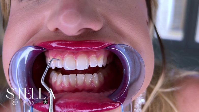 Stellafatale: Strumenti dentali bocca esame tutti i denti visualizzati