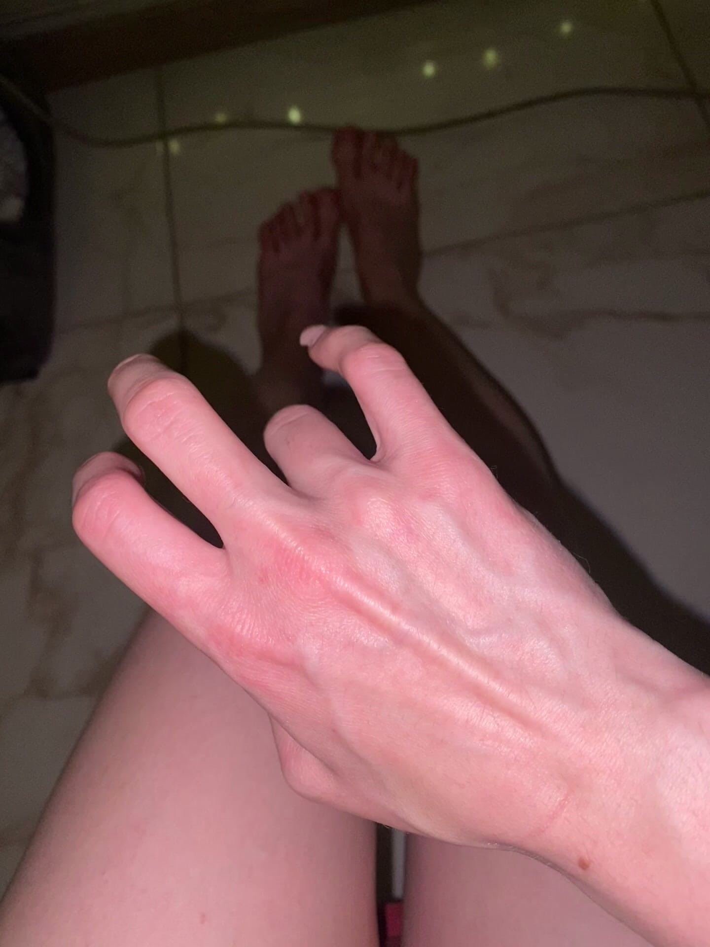 Veins Moving Under the Skin Close up