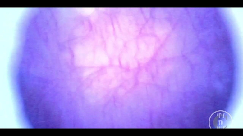 Lina Free: 内視鏡で膀胱満杯の美しい中ハメ撮り!