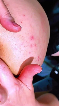 Anální sex - dvě lesby