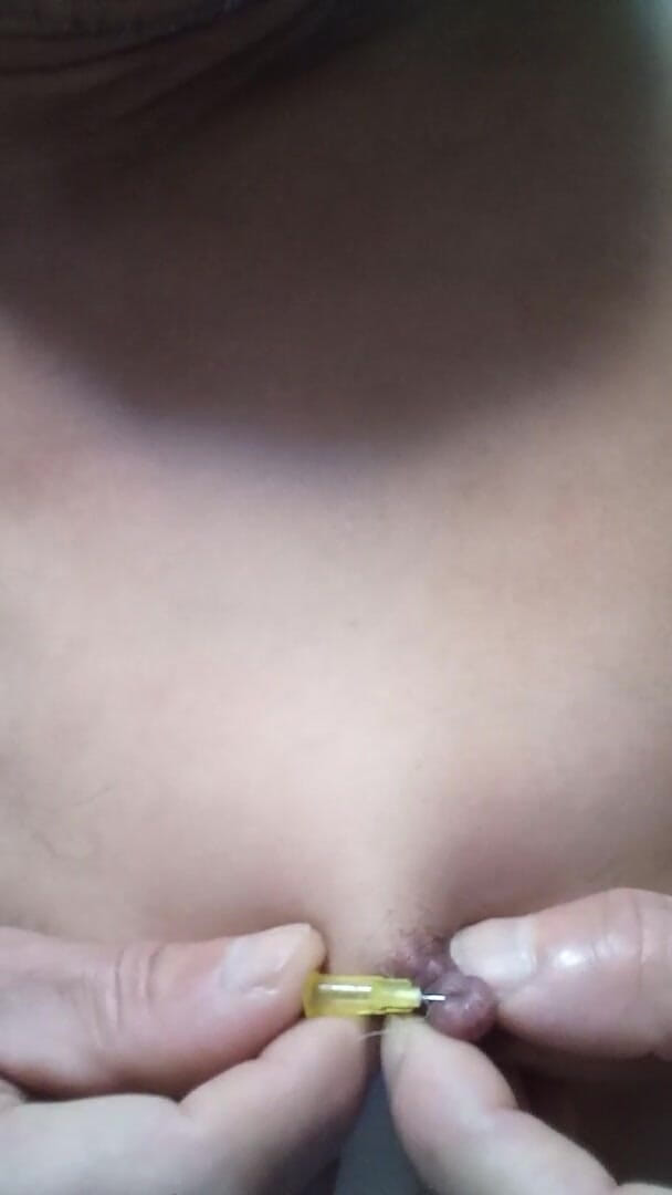Osiritikubi: Niple needle
