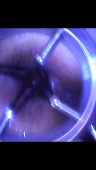 Speculum & Microcamera for Lady Soniac
