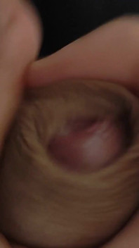 Amazing Pre Cum Glans.