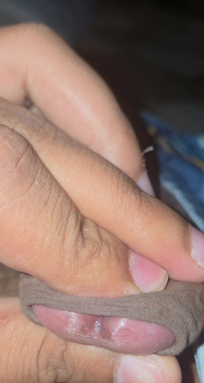 Spiddy: Closeup