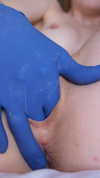 Blue Glove melancap
