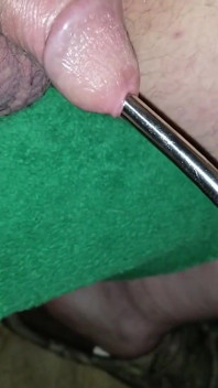 Sondage urétral de 7 à 8 mm avec éjaculation