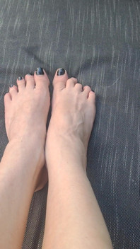 Do We See How Beguiled My Throbbing Foot Veins Are