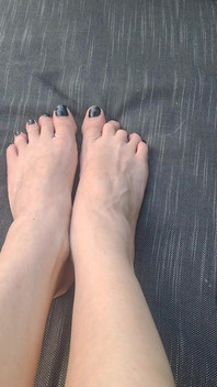 Do We See How Beguiled My Throbbing Foot Veins Are
