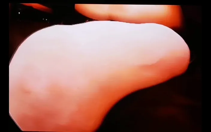 Monster_Meat_: EXTREME video. Filled up with glucose 2,5liter