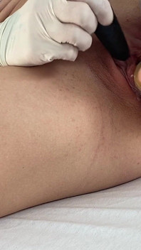 Fétiche des gants mmedical, masturbation avec Ansl Plud, vibromasseur et gode