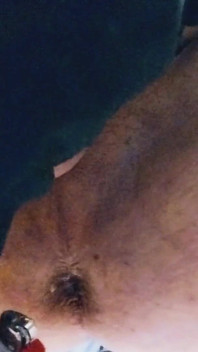 Park and Ride Breeding.