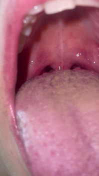 Turul gurii fara machiaj dinti Limba Uvula Tonsil verifica