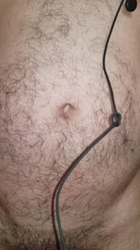 Corpo peludo