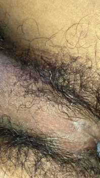 I Need You to Put Your Penis in I Can't Stand This Fever Anymore