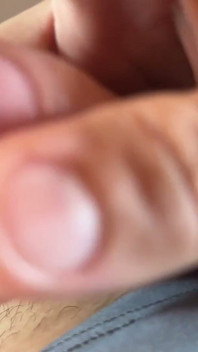 Extreme Detachment of Phimosis with Natural Oil,.