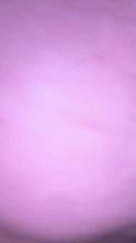 Analni Potěšení