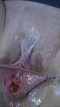 오줌 싸기 4x카메라 닫기