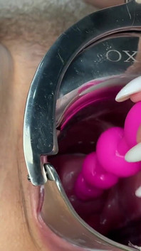 Crazywifeslut Cervix і Peehole Грають