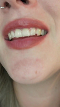 축소 약속 삼키는 판타지