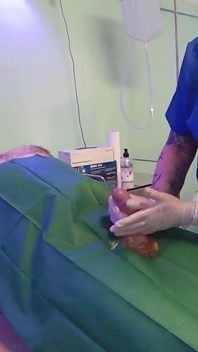 Masturbación médica con la mano