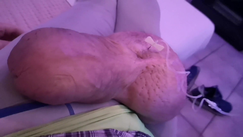 Monster_Meat_: 1リットルのブドウ糖で満腹にする