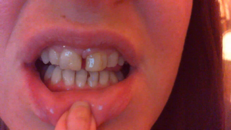 Nicoletta Embassi: Teeth Fetish Devour