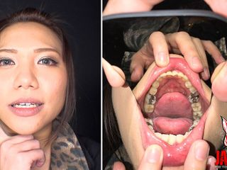 Japan Fetish Fusion: दांतों का जुनून फैलाया गया: Reina Kitamura अभिनीत सनसनीखेज वीडियो