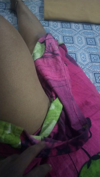 Hot Leg