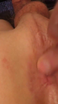 Dilatovaný konečník mladého šprta!