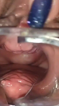 Masturbation with womb view and medical speculum, close up of my pussy