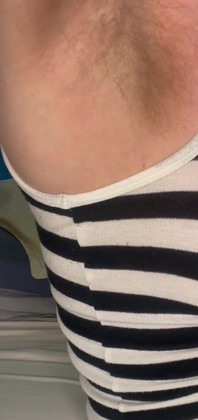 Cspot Showing Armpit Hair